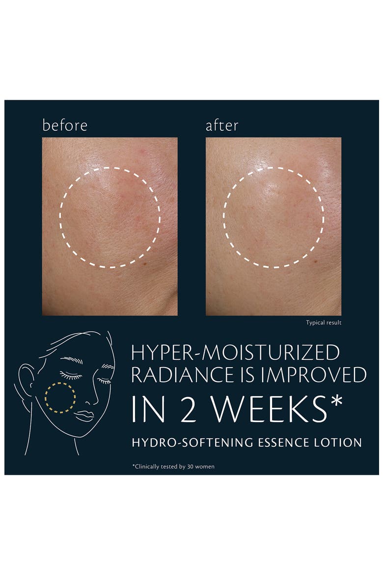 Hydro-Softening Essence Lotion, Alternate, color, NO COLOR