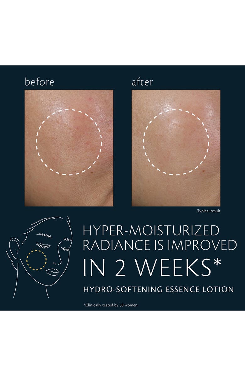 Clé de Peau Beauté Hydro-Softening Essence Lotion, Alternate, color,
