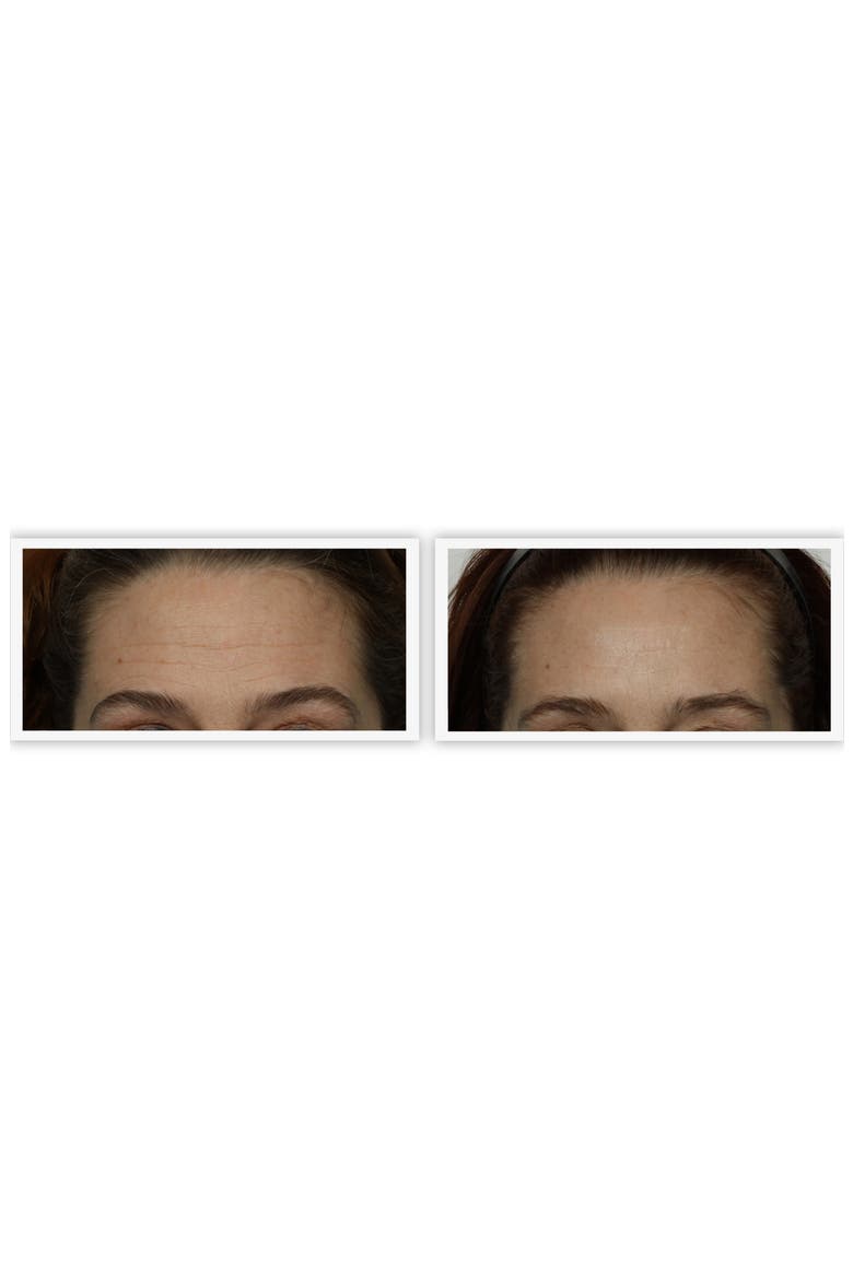 White Trinity® Anniversary Facial Toning Kit, Alternate, color, NO COLOR