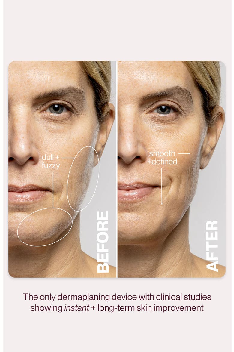 LUXE+ Advanced Sonic Dermaplaning & Peach Fuzz Removal Set $199 Value, Alternate, color, ROSE GOLD