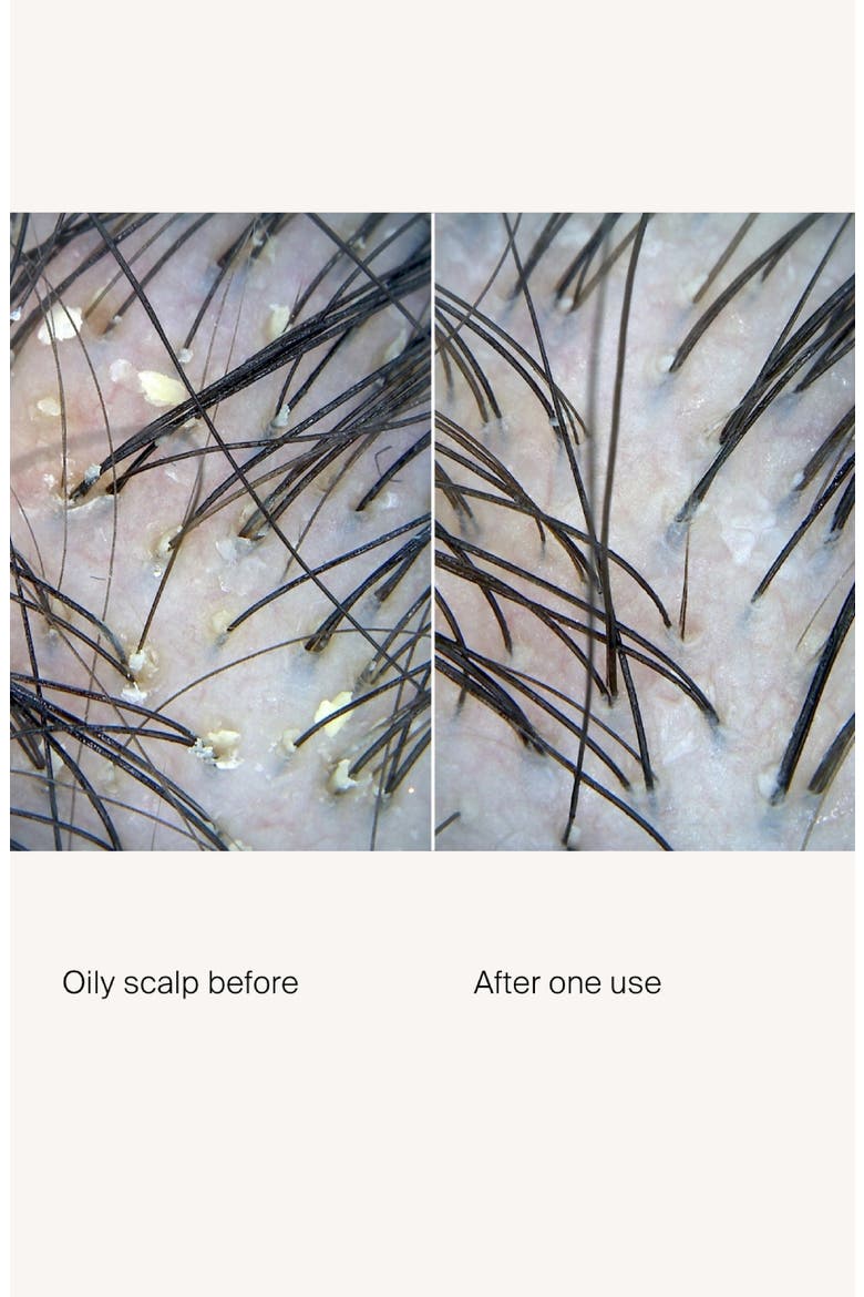 scalp care exfoliator, Alternate, color, NO COLOR