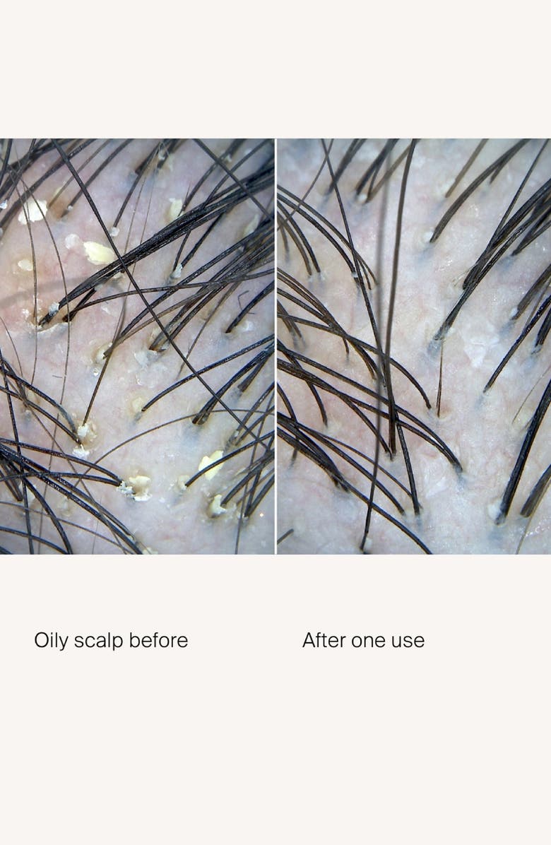 Living proof<sup>®</sup> scalp care exfoliator, Alternate, color, 