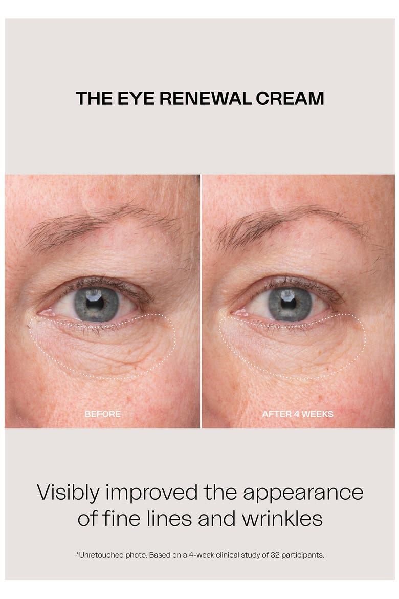 Eye Renewal Cream, Alternate, color, NO COLOR