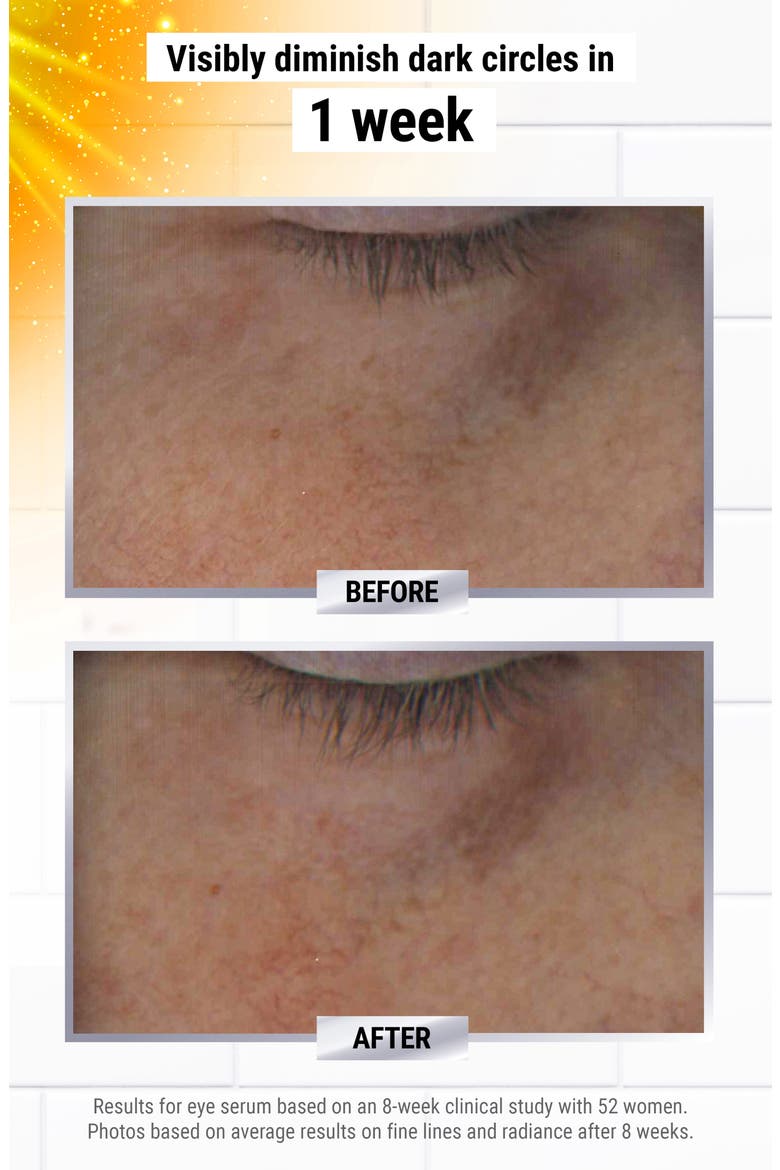 Powerful-Strength Line-Reducing & Dark Circle-Diminishing Vitamin C Eye Serum, Alternate, color, NO COLOR