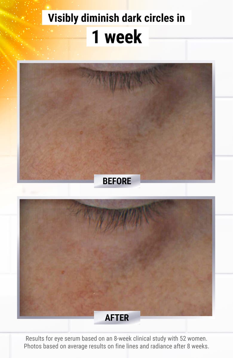 Kiehl's Since 1851 Powerful-Strength Dark Circle Reducing Vitamin C Eye Serum, Alternate, color, 