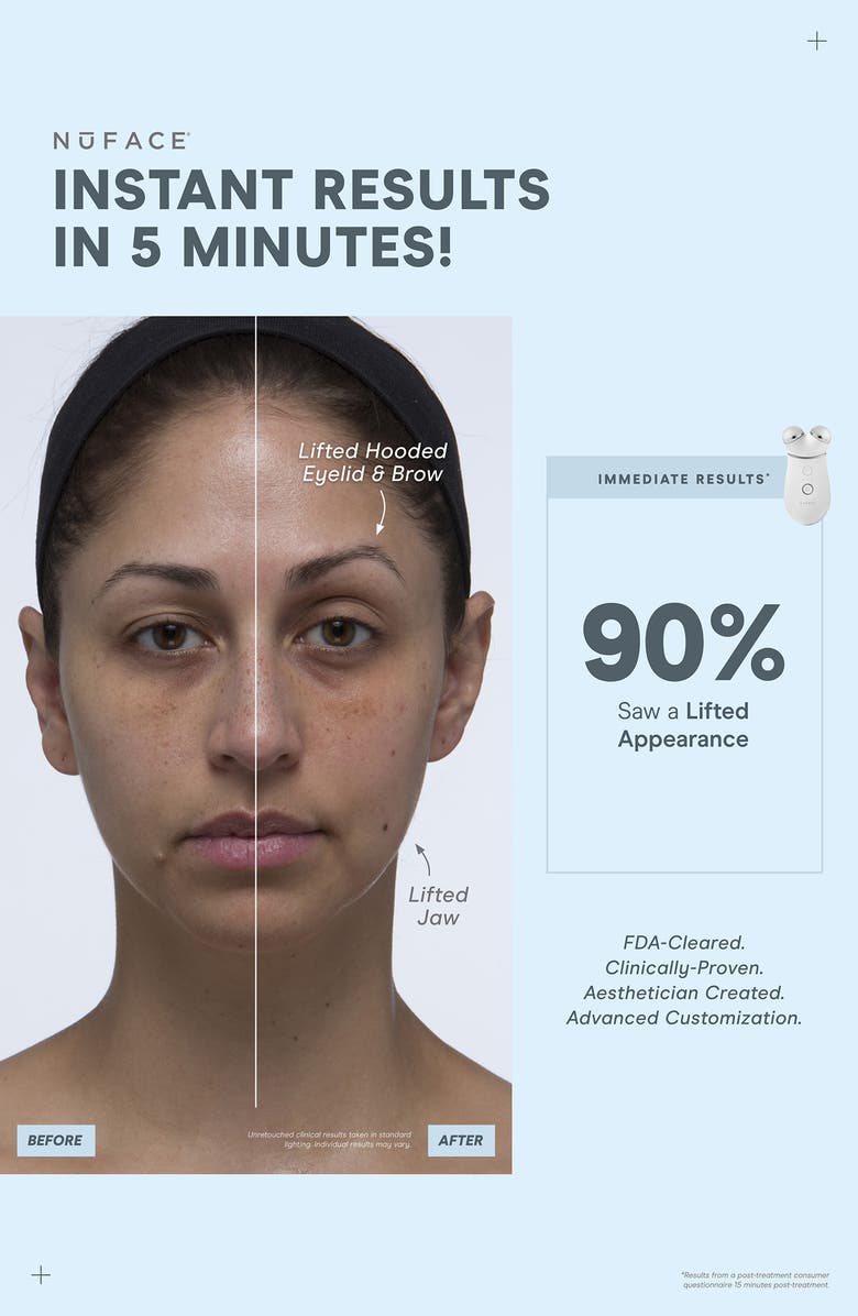 NuFACE<sup>®</sup> Trinity+ Smart Advanced Facial Toning Device System $395 Value, Alternate, color,