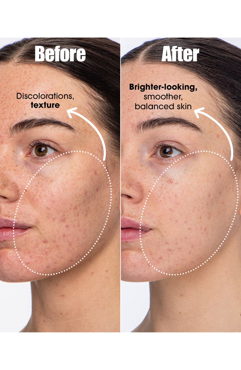 Sunday Riley Detox Darling Pro-Microbiome Balancing Essence, Alternate, color, 