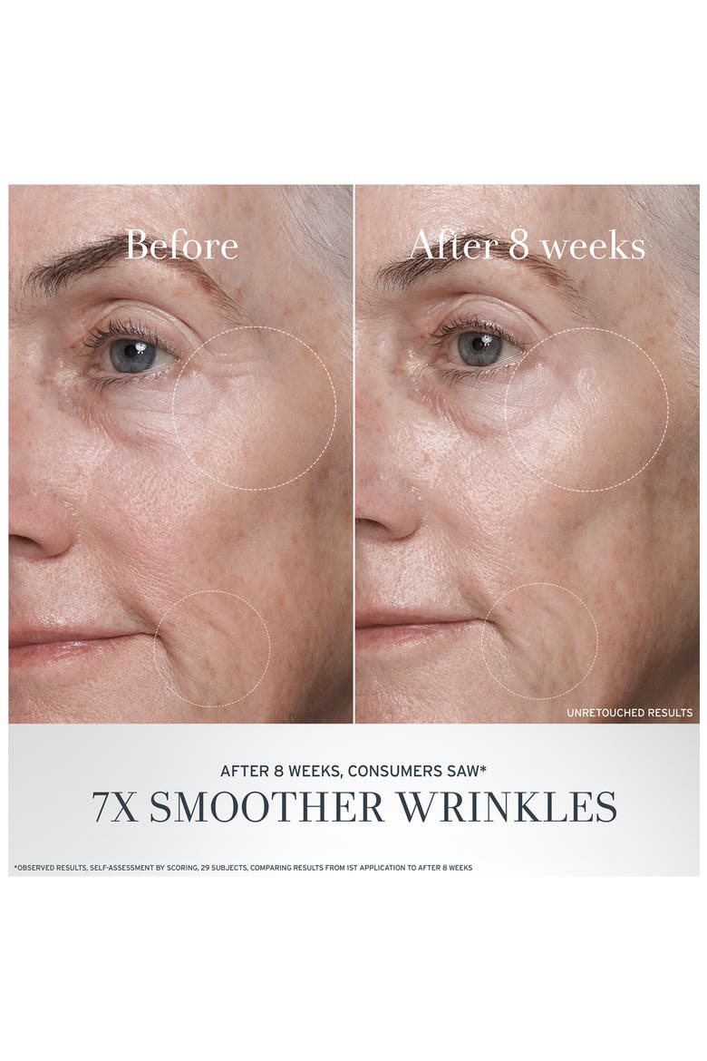 Black Tea Anti-Aging Moisturizer with Retinol Alternative BT Matrix, Alternate, color, NO COLOR