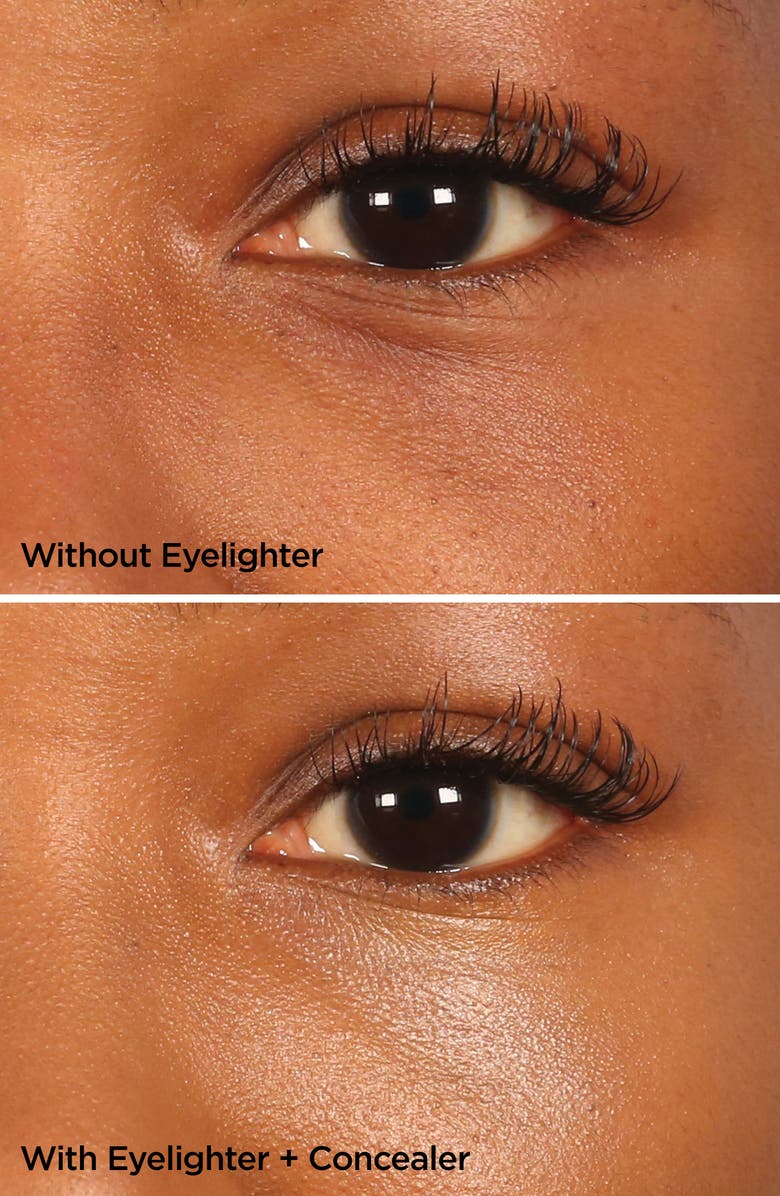 BeautyBio The Eyelighter Concentrate Smoothing, Brightening Serum & Depuffing Tool, Alternate, color,