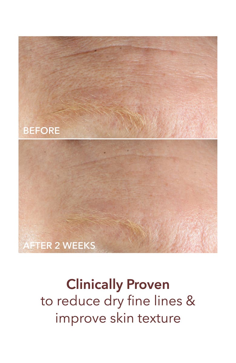 Dr. Dennis Gross Skincare Advanced Retinol + Ferulic Intense Wrinkle Cream, Alternate, color, 