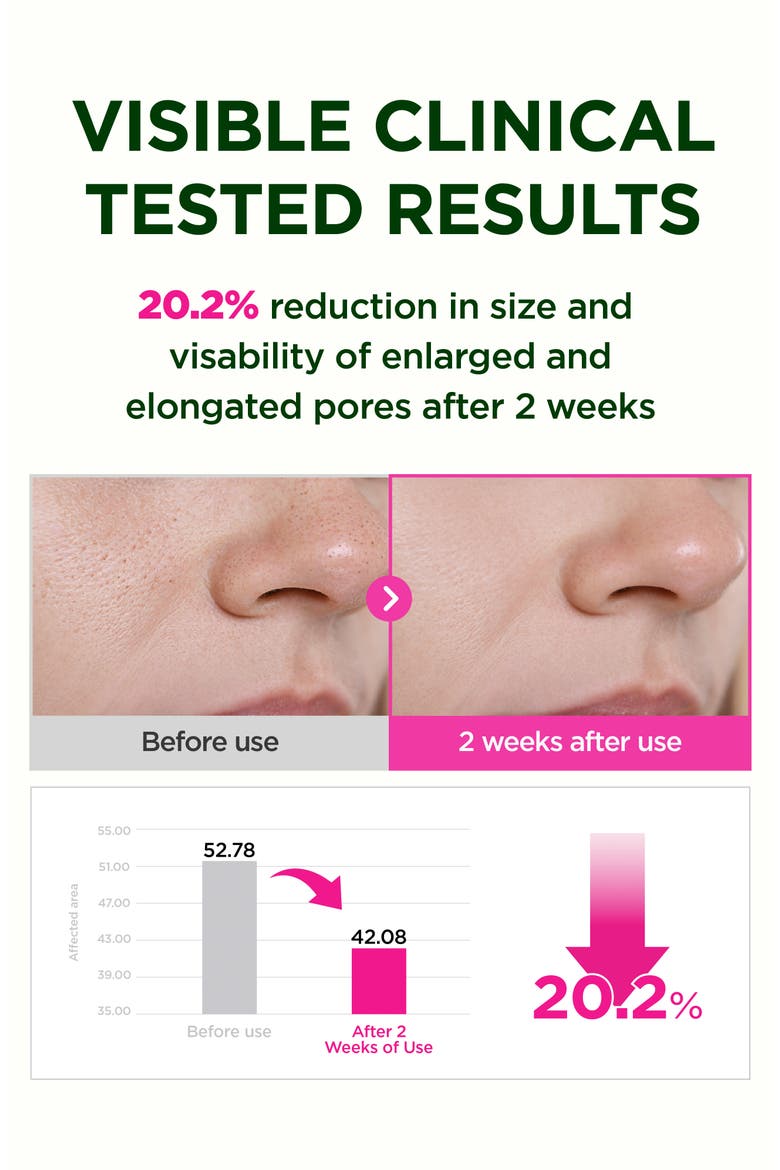 Retino Collagen Small Molecule 300 Pore & Elasticity Mask Set, Alternate, color, NO COLOR