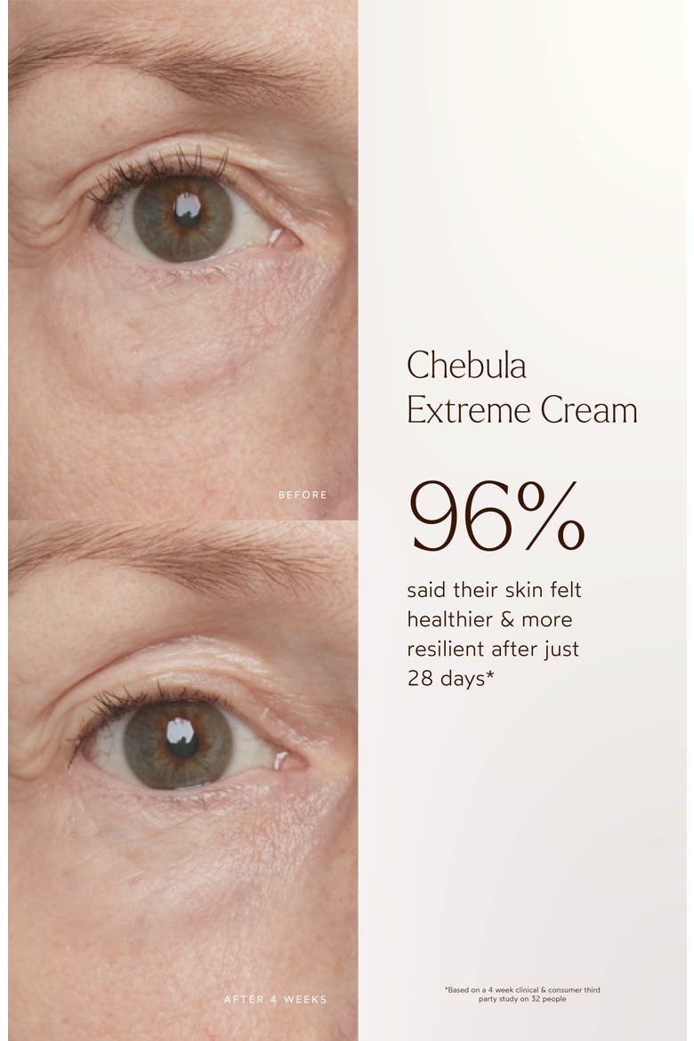 Irresistible Skin Longevity Set (Limited Edition) (Nordstrom Exclusive) $279 Value, Alternate, color, NO COLOR