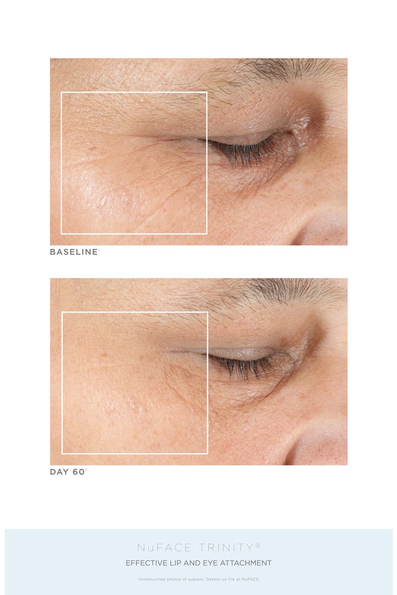 Trinity® Complete Facial Toning Kit (Limited Edition), Alternate, color, NO COLOR