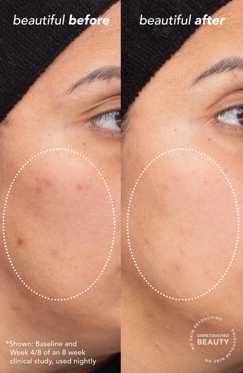 TULA Skincare Bedtime Bright<sup>™</sup> Vita-Charge<sup>™</sup> Overnight Brightening Treatment, Alternate, color,