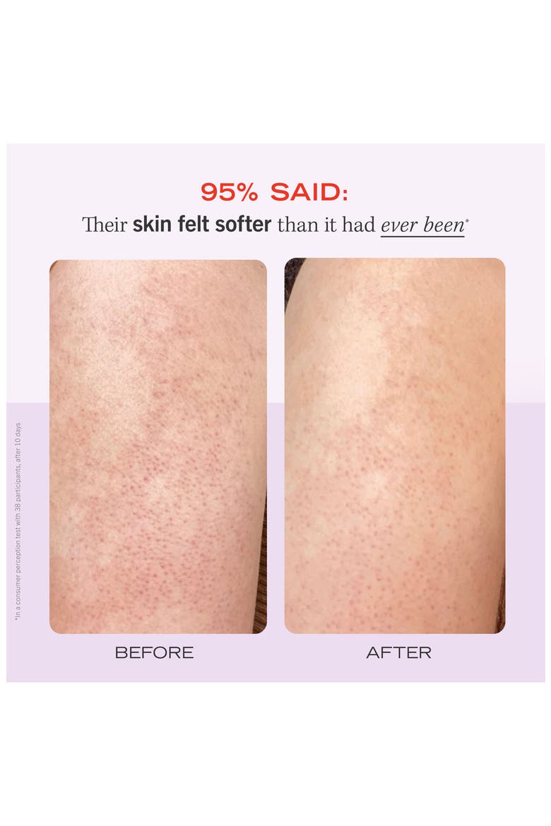KP Bump Eraser Body Scrub, Alternate, color, NO COLOR