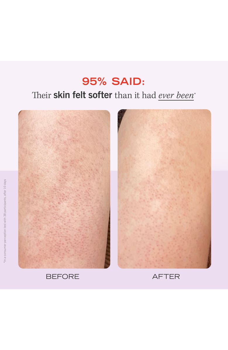 First Aid Beauty KP Bump Eraser Body Scrub, Alternate, color,