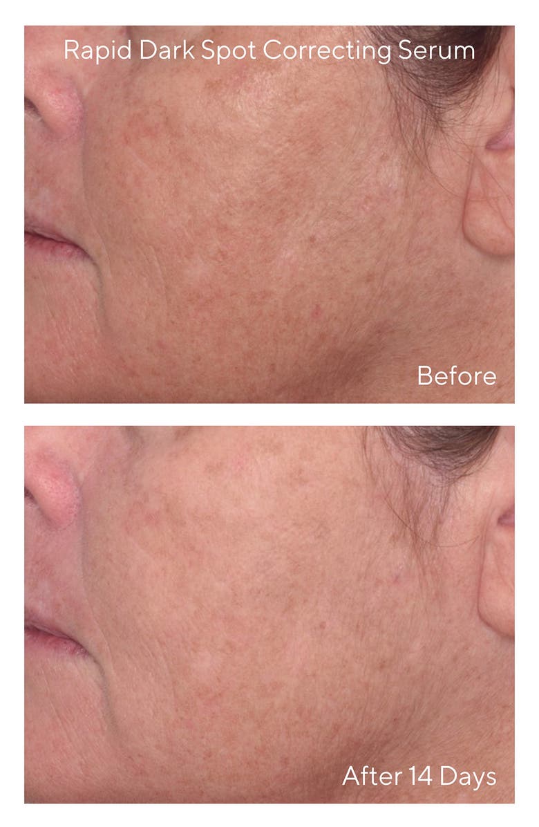 Murad<sup>®</sup> Murad Travel Size Brighten Skin Care Set USD $92 Value, Alternate, color, 