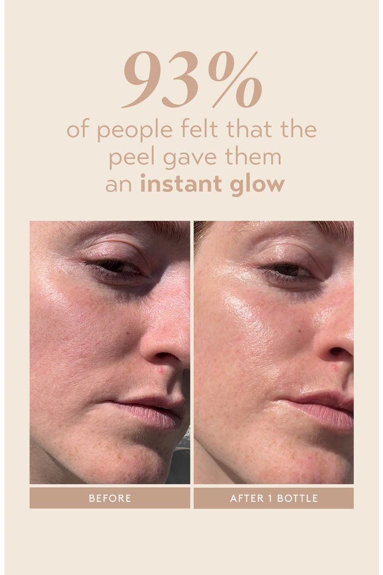 Triple Acid Signature Peel, Alternate, color, NO COLOR