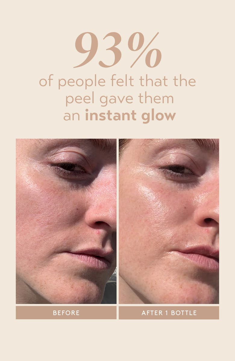 Shani Darden Skincare Triple Acid Signature Peel, Alternate, color, 