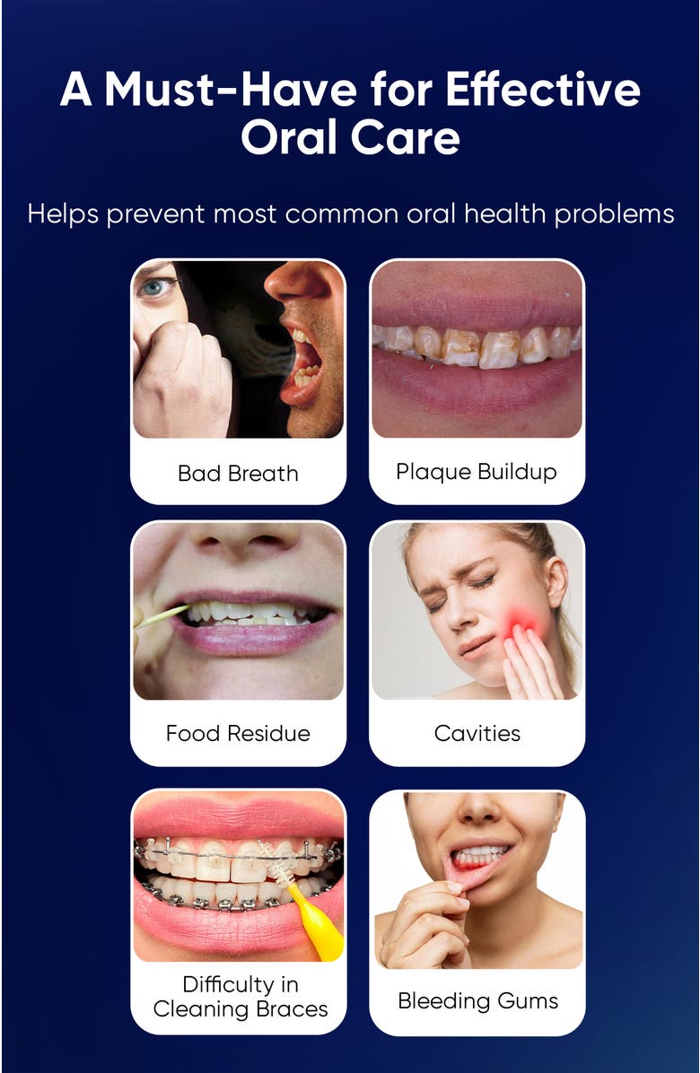 MySmile LP211 Cordless Water Flossers for Teeth, 260ML Reservoir, 5 Cleaning Modes, 8 Jet Tips, Alternate, color, Black