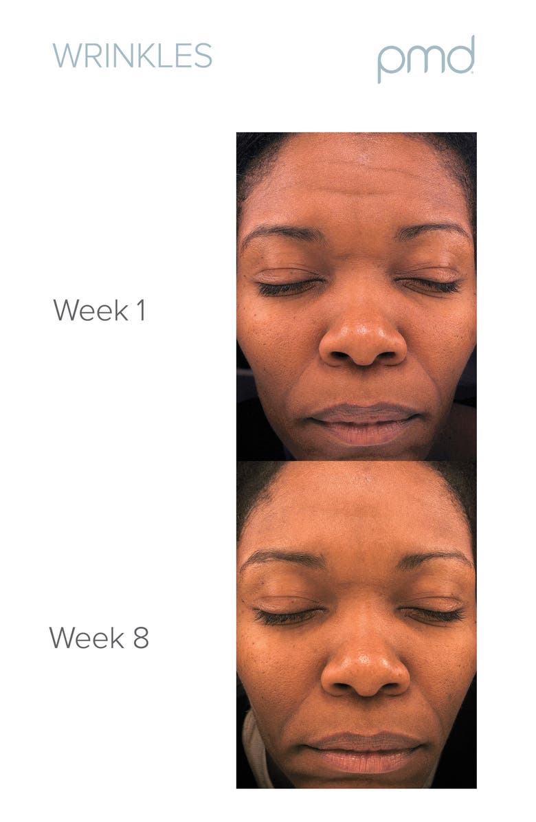 PMD Personal Microderm Pro Exfoliation Device, Alternate, color, Blush