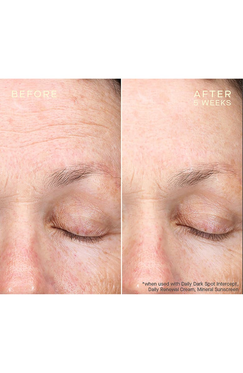 Ourself Dark Spot Intercept, Alternate, color,