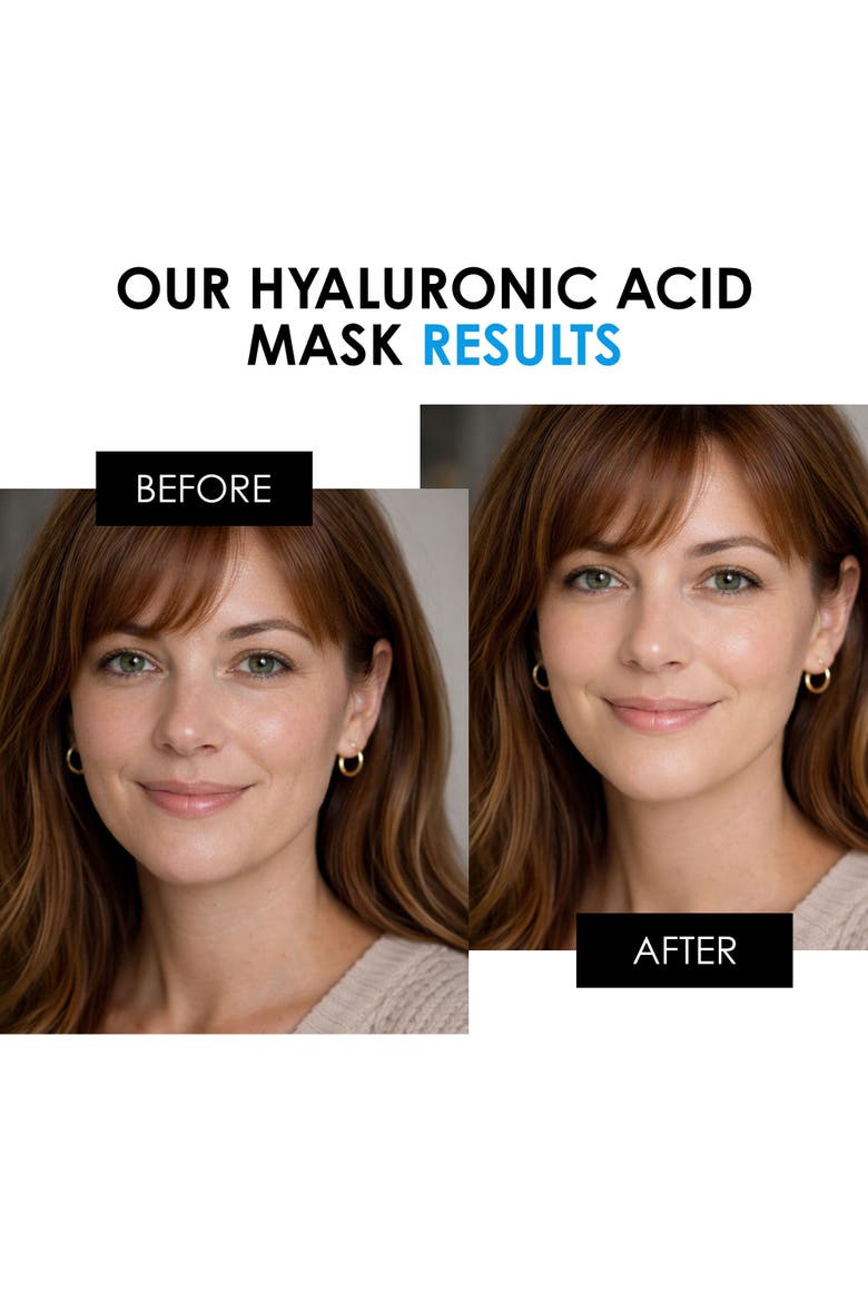 Anti-Aging Hyaluronic Acid Mask 50ml for Dryness, Fine Lines & Wrinkles, Alternate, color, White
