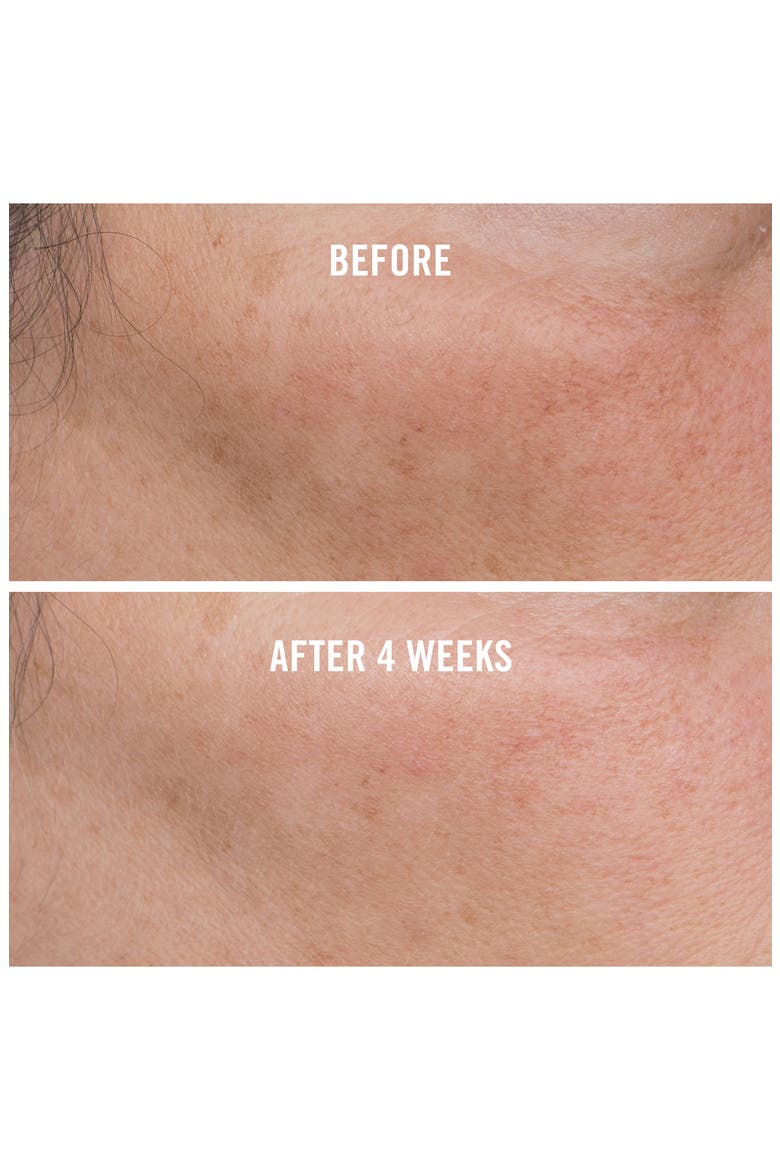 Facial Radiance Niacinamide Dark Spot Serum, Alternate, color, NO COLOR