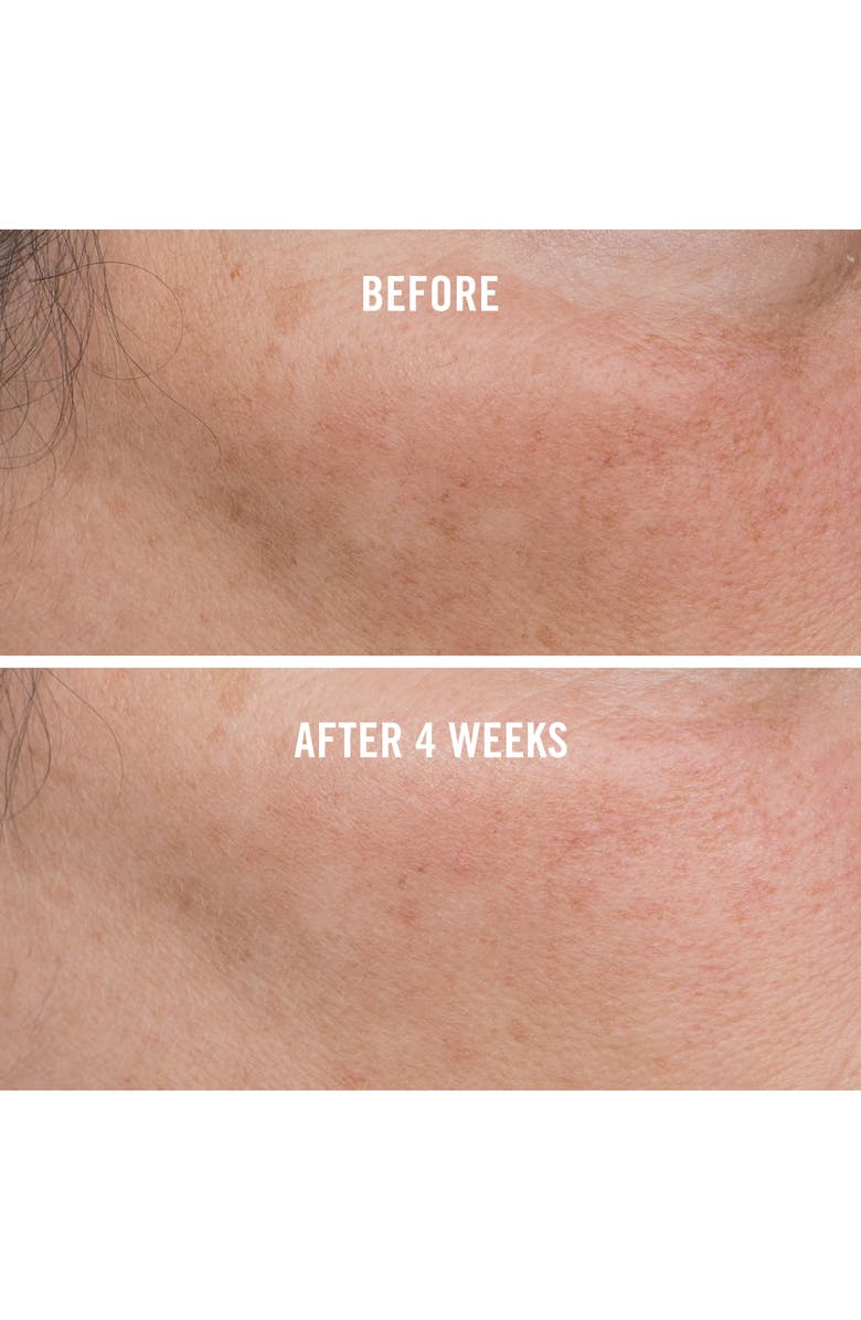 First Aid Beauty Facial Radiance Niacinamide Dark Spot Serum, Alternate, color,