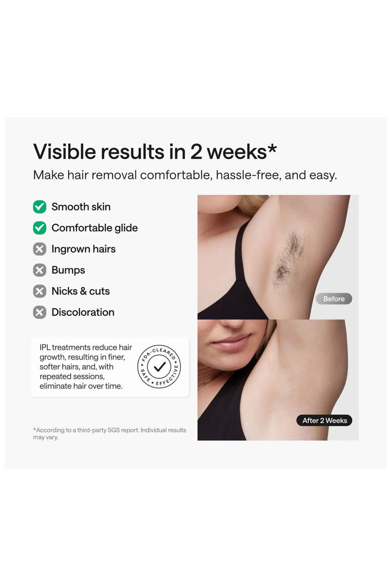 Swift 5 IPL Hair Removal Device, Alternate, color, PURPLE