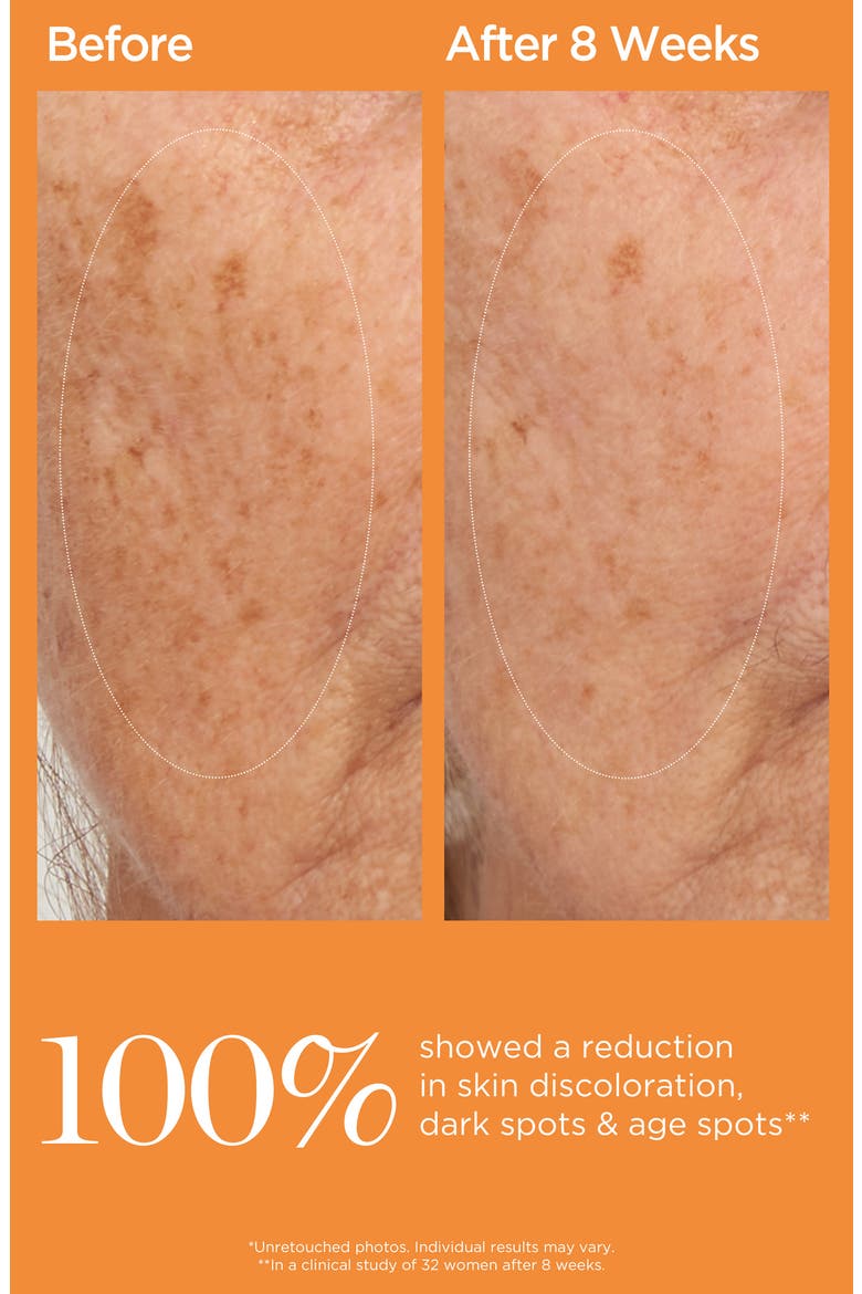 Vitamin C Ester 20% Dark Spot Corrective Serum, Alternate, color, NO COLOR
