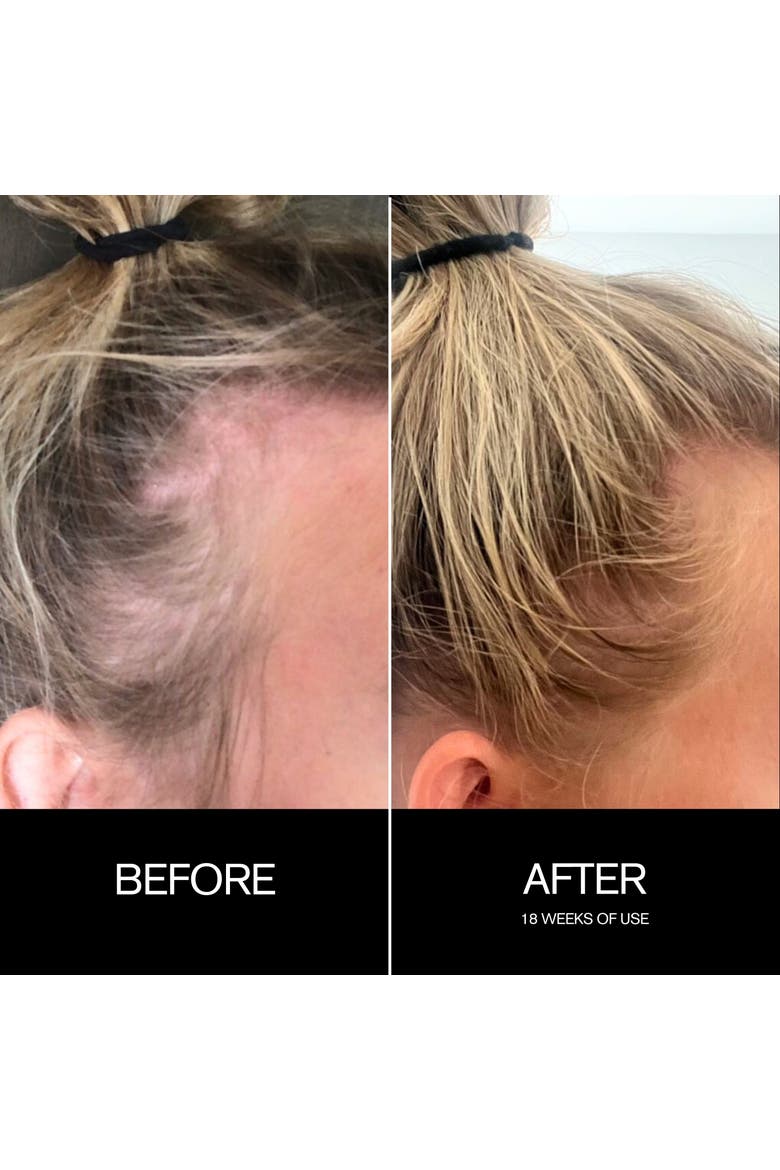 Follicle Drops, Alternate, color, none