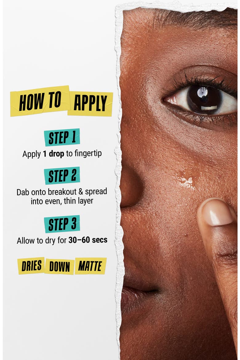 Truly Targeted Acne Clearing Solution, Alternate, color, NO COLOR