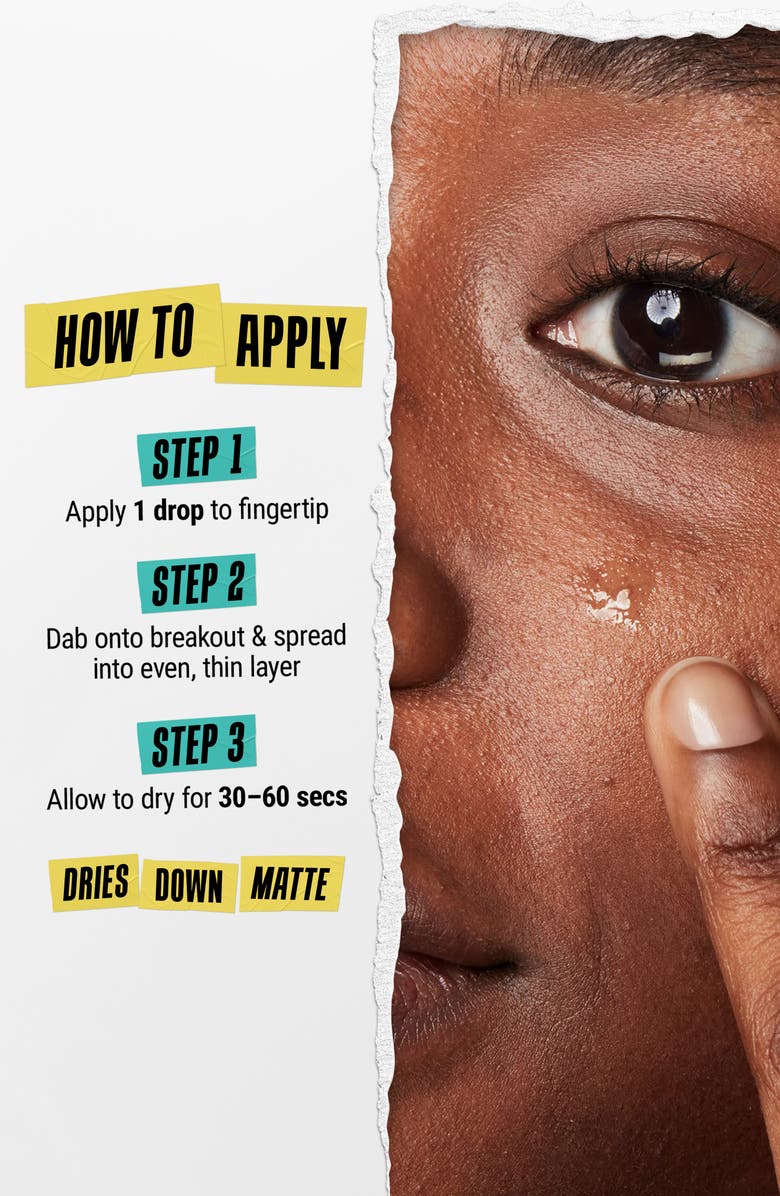 Kiehl's Since 1851 Truly Targeted Acne Clearing Solution, Alternate, color, 