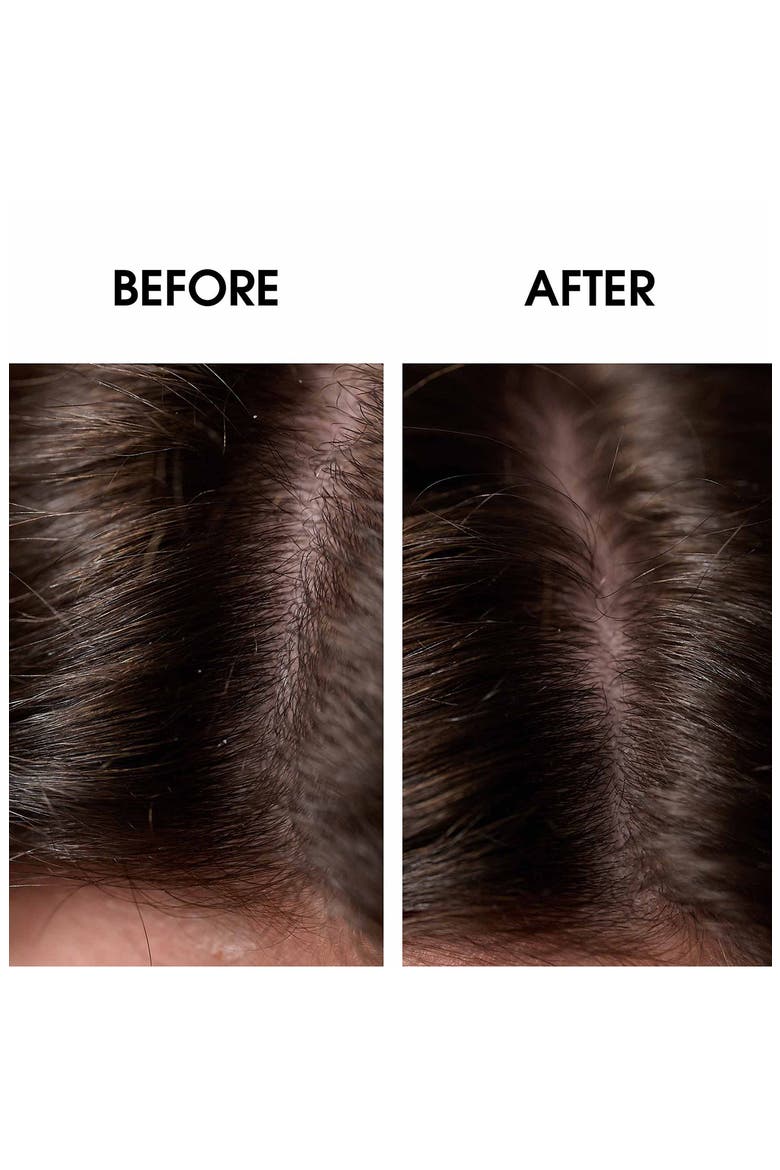 Bain Traitant à la Propolis Gentle Soothing & Dandruff Treatment Shampoo, Alternate, color, NO COLOR