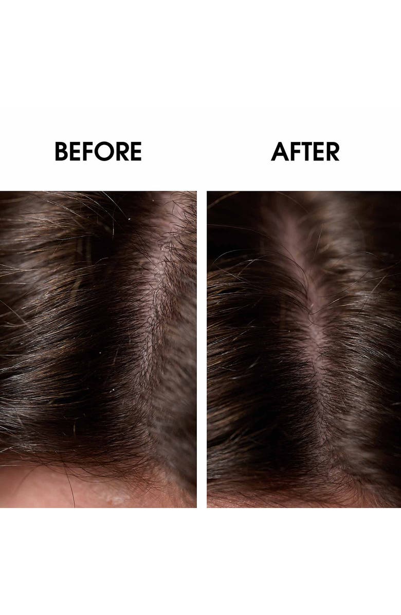 Leonor Greyl PARIS Bain Traitant à la Propolis Gentle Soothing & Dandruff Treatment Shampoo, Alternate, color, 