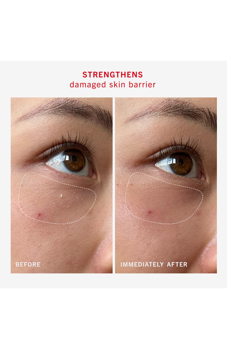 First Aid Beauty Ultra Repair Rescue Barrier Balm with Dimethicone, Alternate, color, 