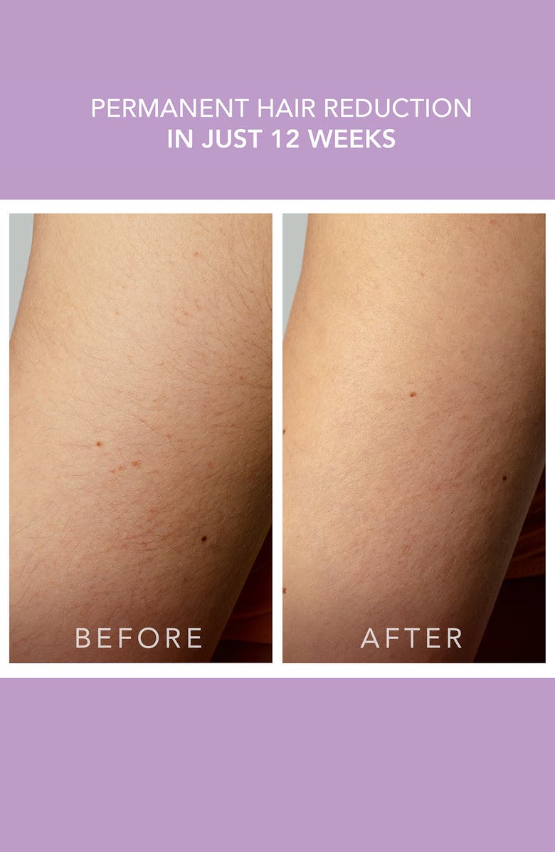 FOREO PEACH 2 Go Advanced Hair Removal Device, Alternate, color, Lavender