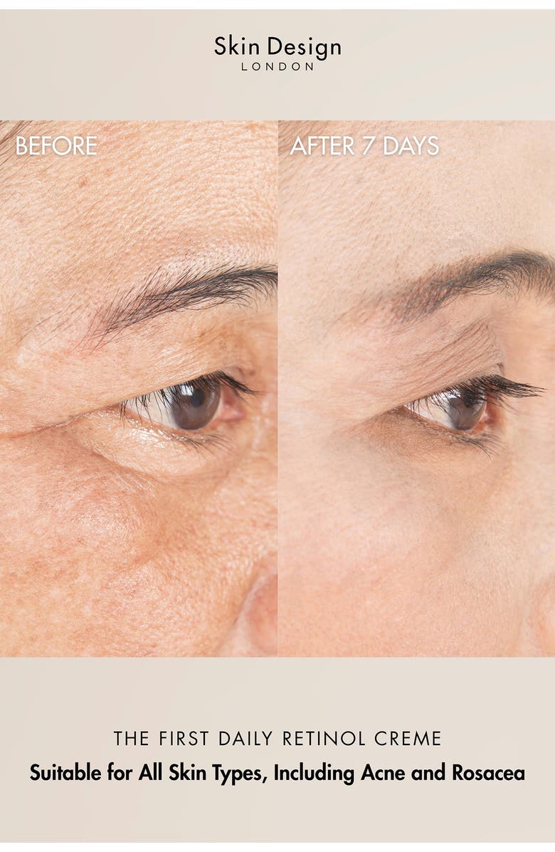 Skin Design London Retinol Gel Crème, Alternate, color,