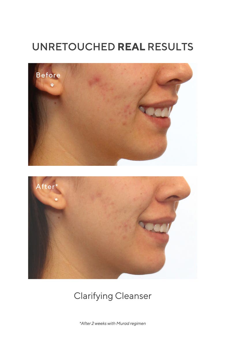 Clarifying Cleanser, Alternate, color, NO COLOR