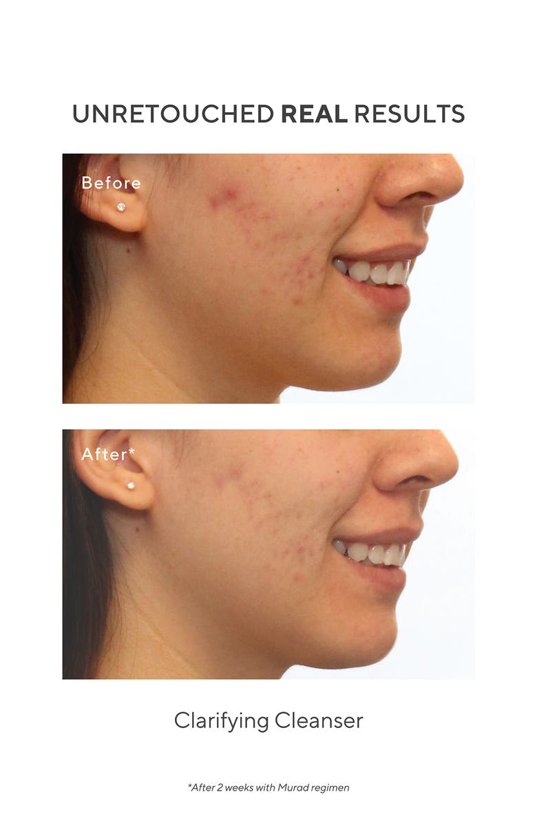 Murad<sup>®</sup> Clarifying Cleanser, Alternate, color,
