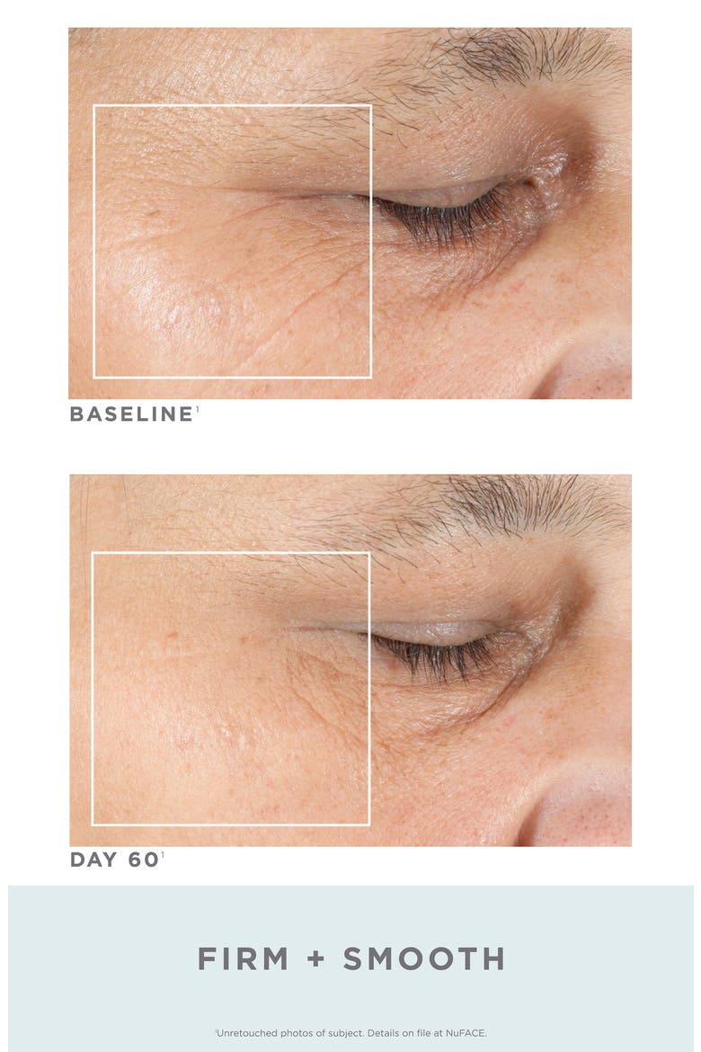 Trinity® Facial Trainer Kit + Trinity Eye & Lip Enhancer Attachment, Alternate, color, NO COLOR