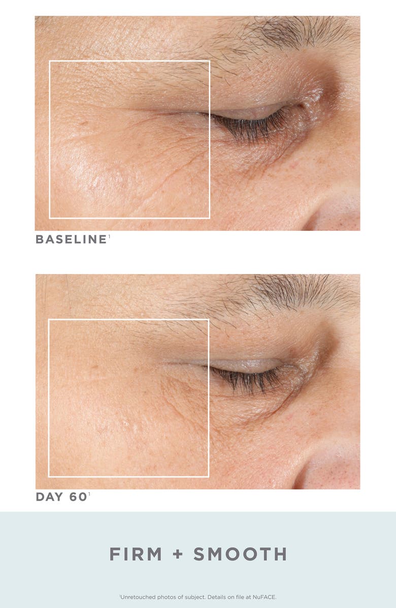 NuFACE<sup>®</sup> Trinity<sup>®</sup> Facial Trainer Kit + Trinity Eye & Lip Enhancer Attachment, Alternate, color, 