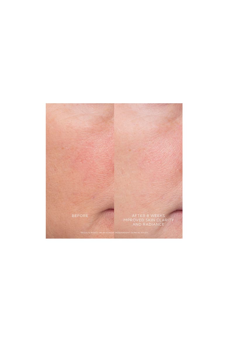 Equilibrium Resurfacing Retinoid Treatment, Alternate, color, NO COLOR