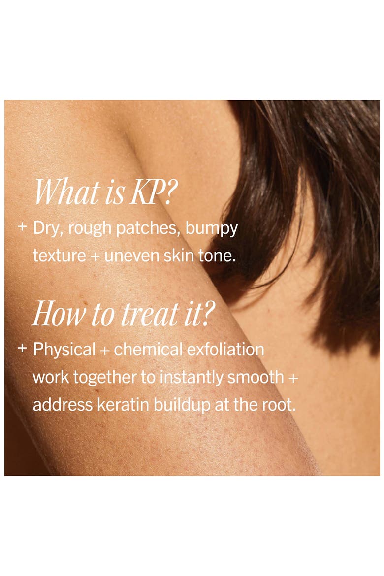 KP Bump Eraser Body Scrub 10% AHA - Polished Radiance Duo $60 Value, Alternate, color, NO COLOR