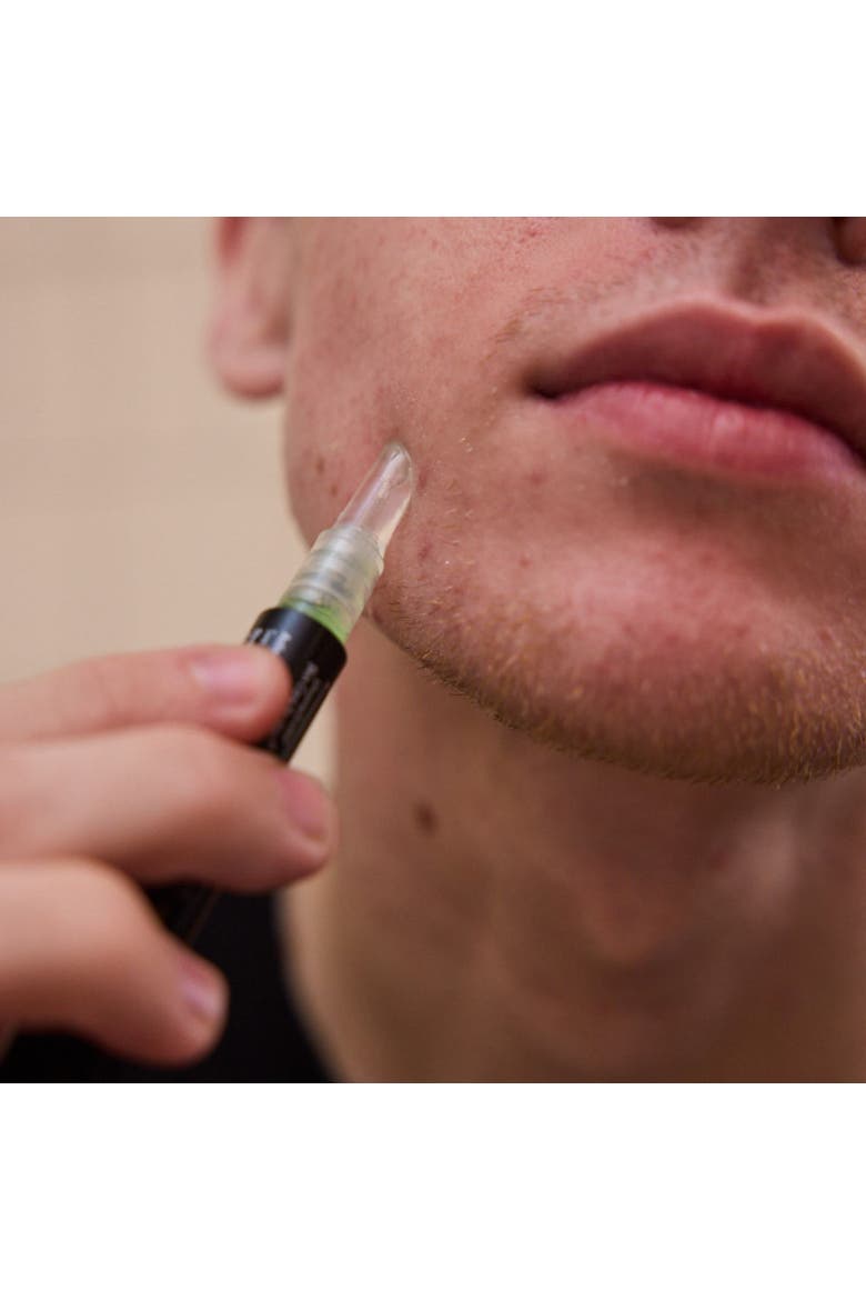 Acne Gel Pen, Alternate, color, Black