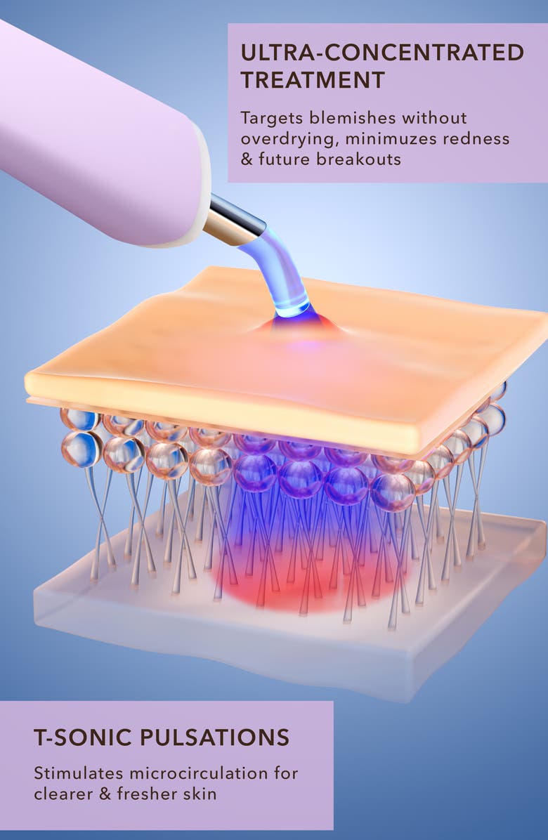 FOREO ESPADA 2 plus Targeted Blue LED Light Acne Treatment, Alternate, color, 