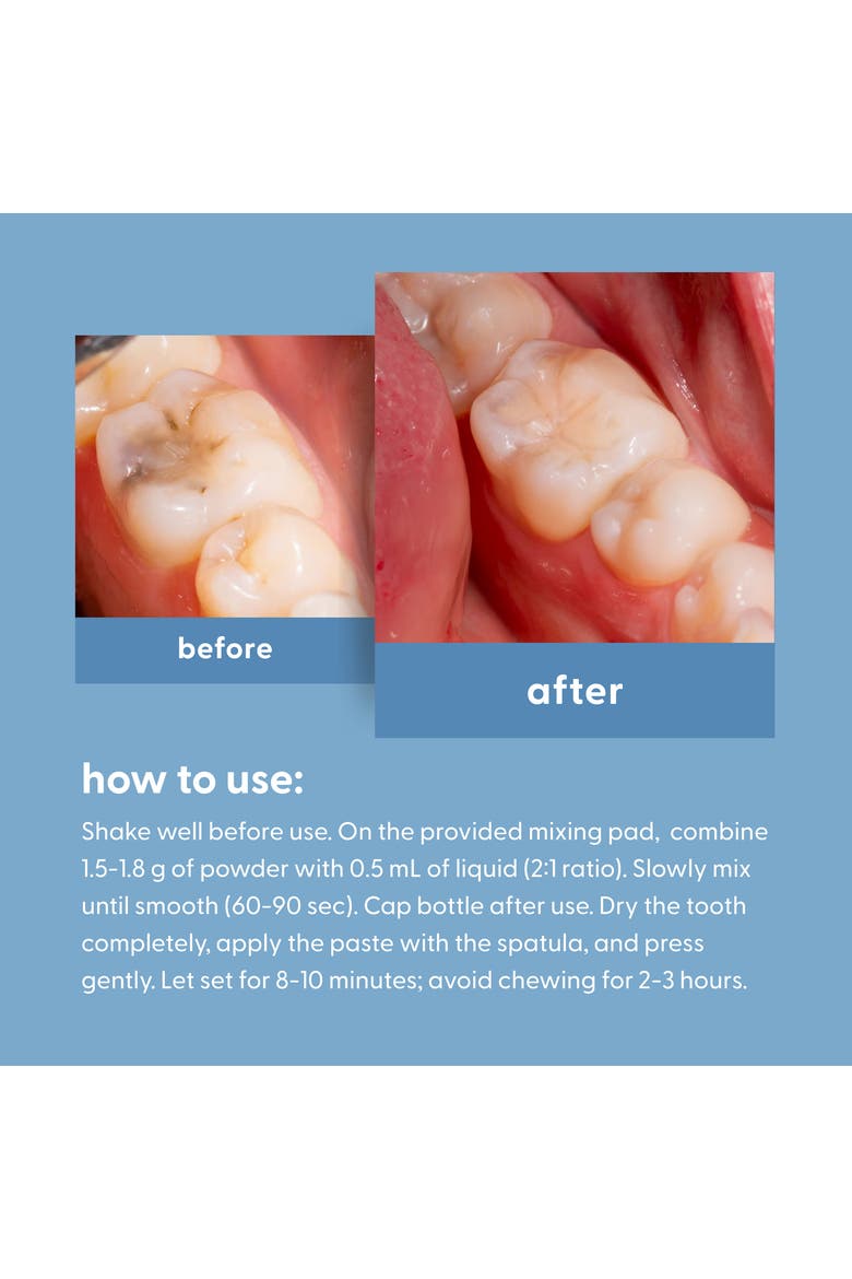 Temporary Tooth Repair Kit with Travel Case, Alternate, color, No Colour