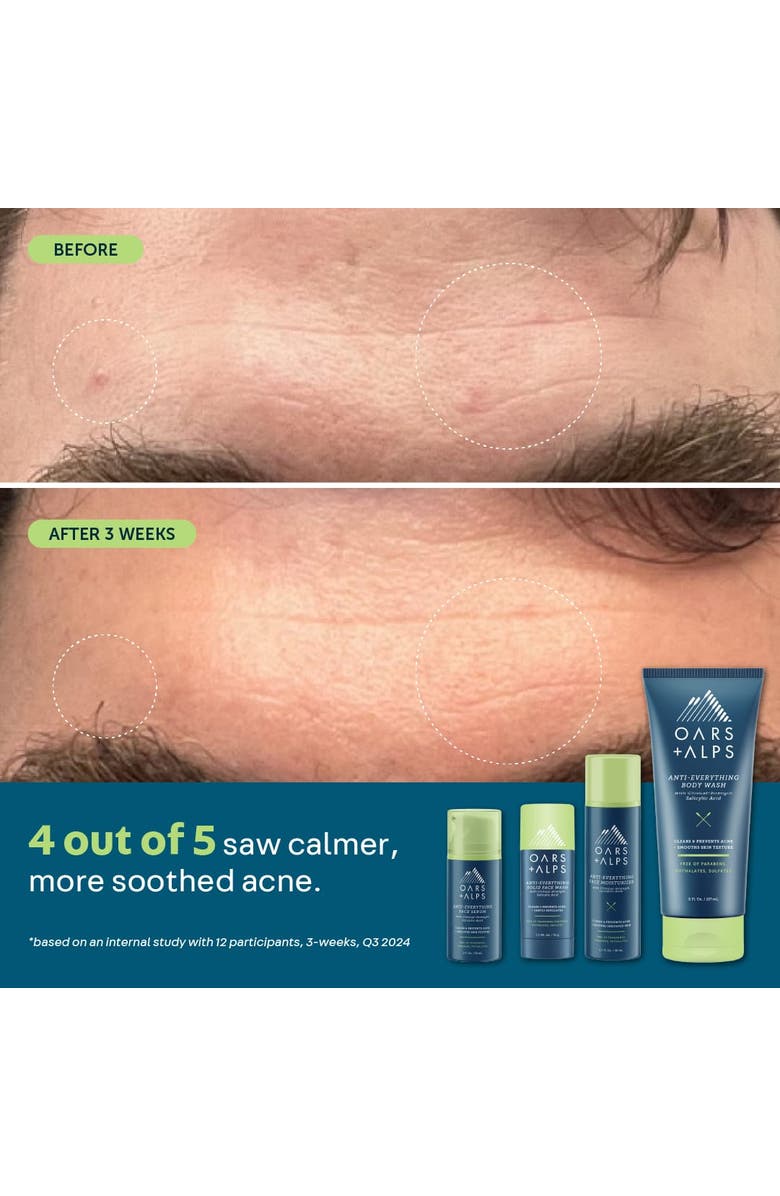 OARS + ALPS Anti-Everything Face Moisturizer, Alternate, color, Blue