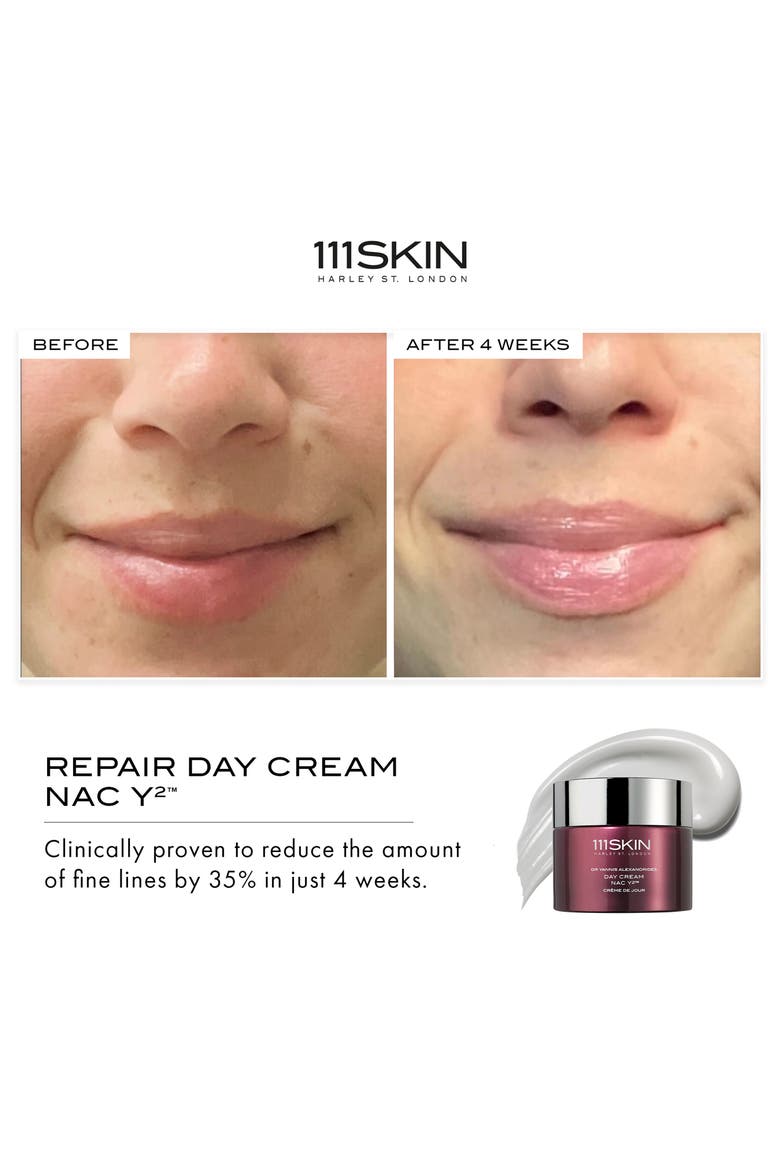 Day Cream NAC Y2, Alternate, color, NO COLOR